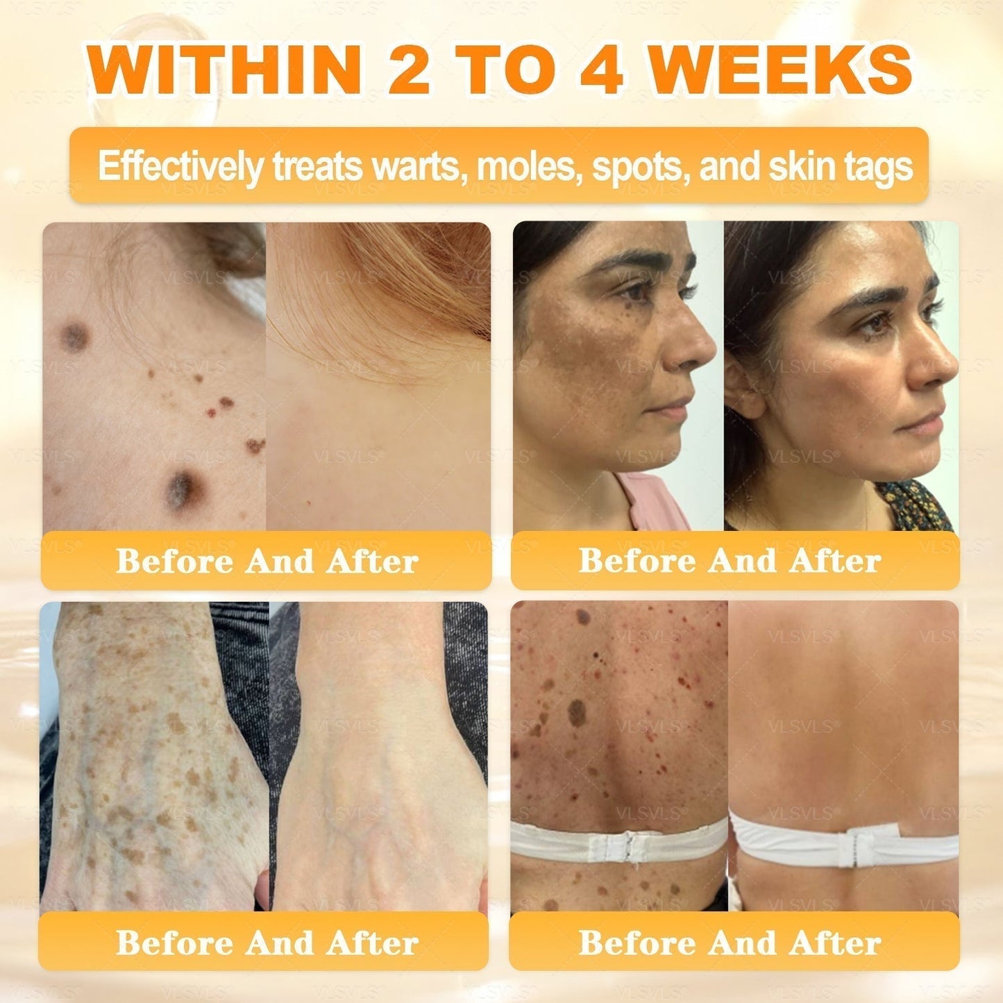 【𝟐𝟎𝟐𝟔 𝐍𝐞𝐰 𝐔𝐩𝐠𝐫𝐚𝐝𝐞: 𝟖𝟎% 𝐎𝐅𝐅】📎📎🍯Aeehfeng® Bee Venom Skin Restoration Cream – with Royal Jelly, Hyaluronic Acid and Bee Venom for skin hydration, elasticity, anti-aging & repair